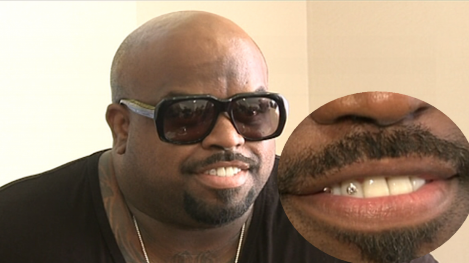 Video VIP zprávy: Zpěvák Cee Lo Green má ve dvou předních zubech vsazené diamanty. Podívejte se!